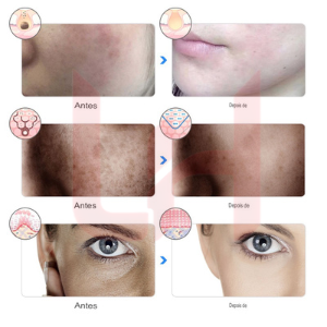 Máscara LED Facial™
