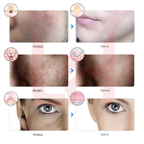 Máscara LED Facial™